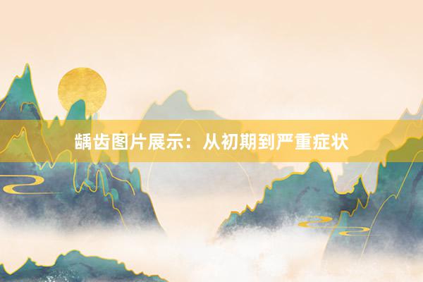 龋齿图片展示：从初期到严重症状